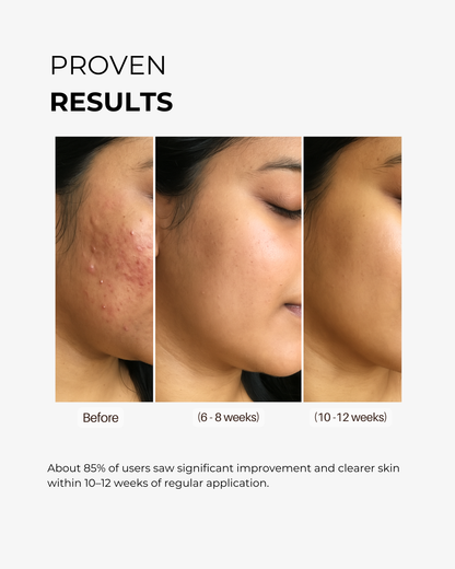 Snail Mucin Face Serum