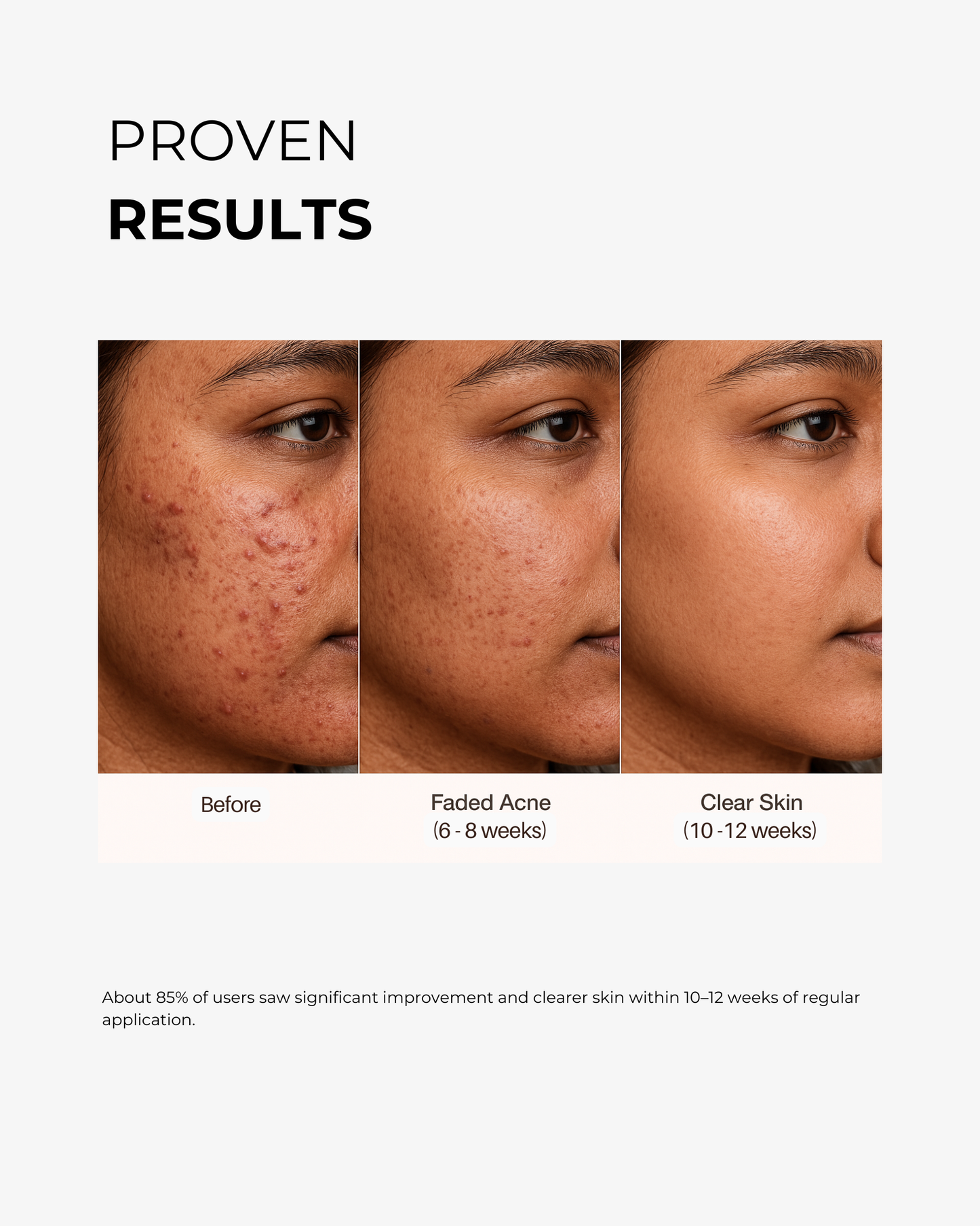 10% Niacinamide Face Serum